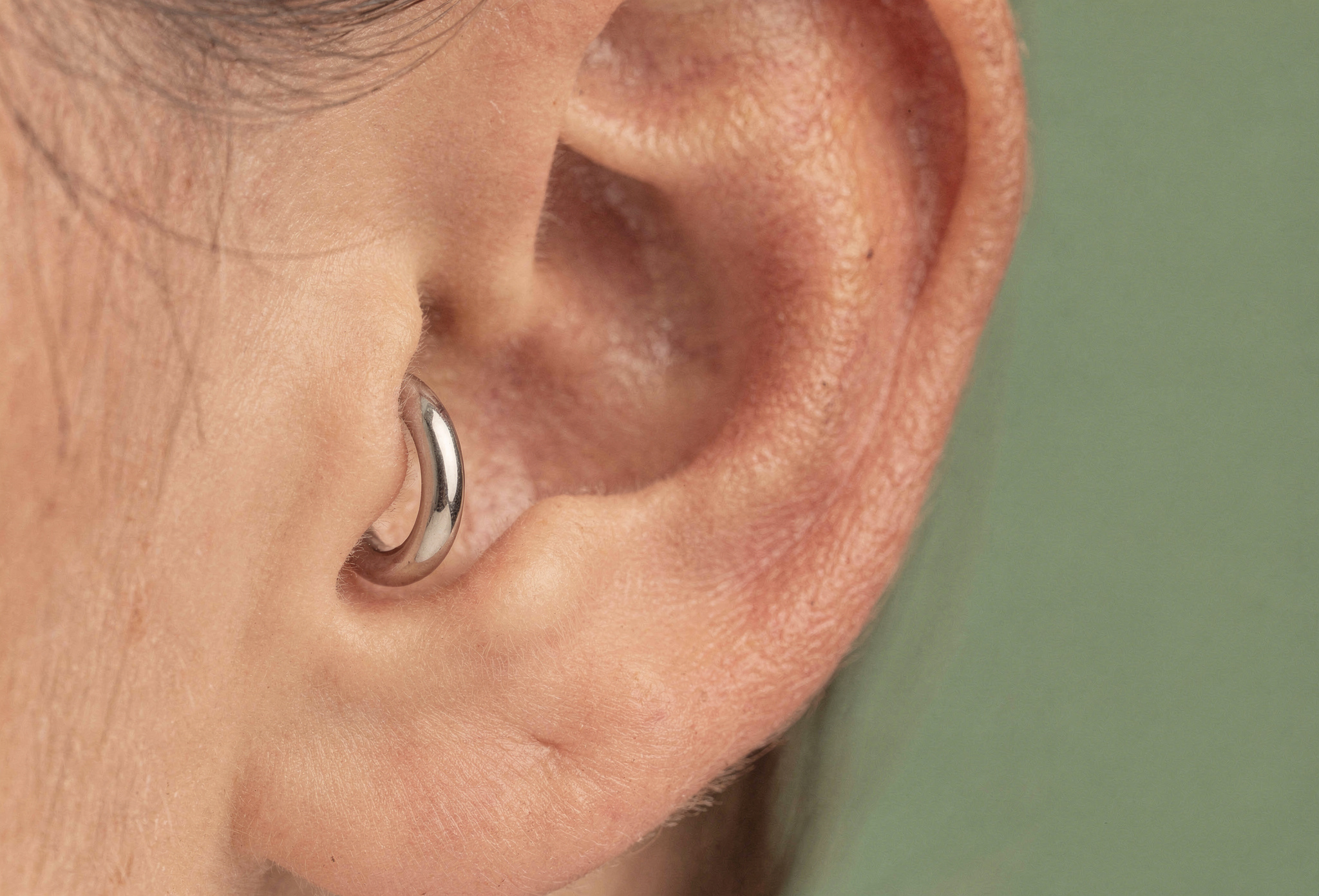 İyileşmiş helix piercing, 8. ay